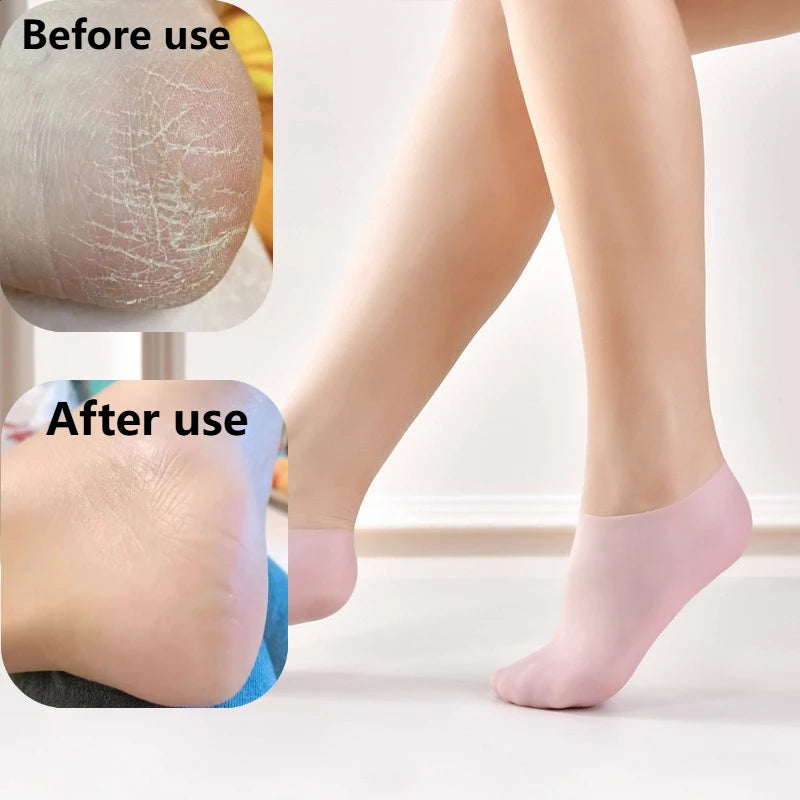 Meia de silicone hidratante para pés ressecados e confortáveis.